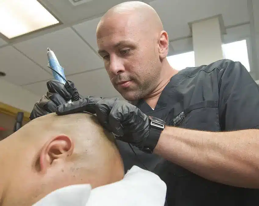 Read more about the article What to Expect At Your Scalp Micropigmentation Sessions
