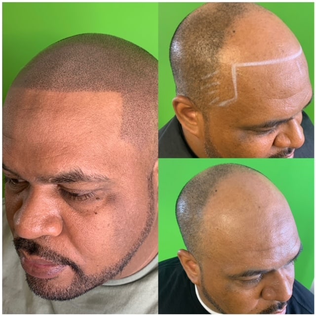 A guy that has their hair repaired